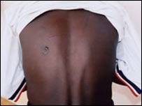 Joseph (photo: Unicef)